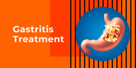 Exploring the Complex Relationship Between Hiatus Hernia, GERD, and Stomach Bloating