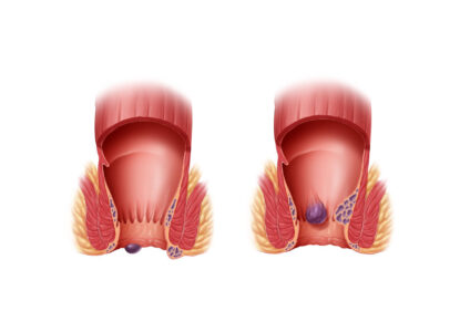 Gut Health Diet Plan for Kenyans: A Practical Weekly Guide